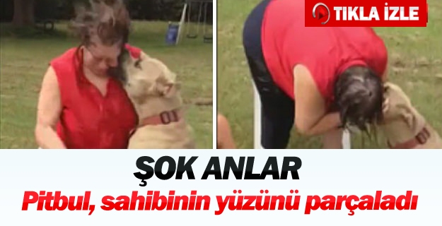 Pitbul, sahibinin yüzünü parçaladı